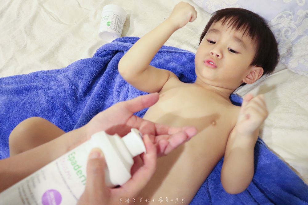 益皮特異位性皮膚炎寶寶治療照護方式
